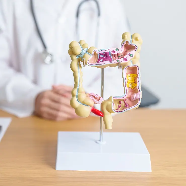 Doctor with human Colon anatomy model. Colonic disease, Large In