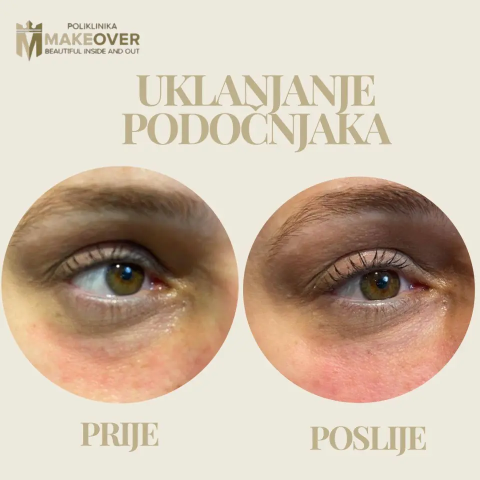 Filteri su out, “skin quality” je in! Evo što danas ljudi traže umjesto šminke i filtera