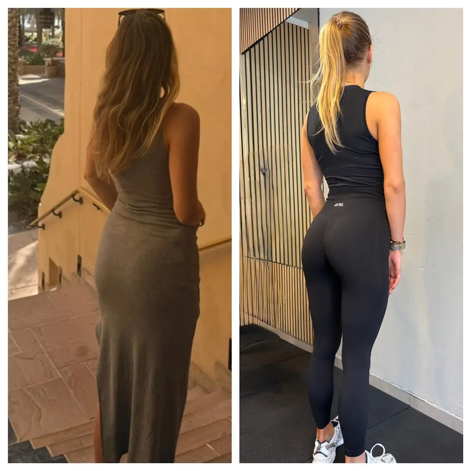 Gluteus se ne trenira samo zbog izgleda! Glute Fit Gym spaja zdravlje i dobru formu
