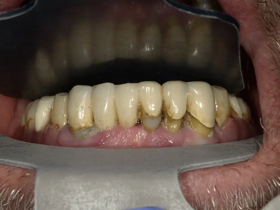 Kompleksan dentalni problem? Ovdje ga ne rješava jedan liječnik, nego cijeli tim