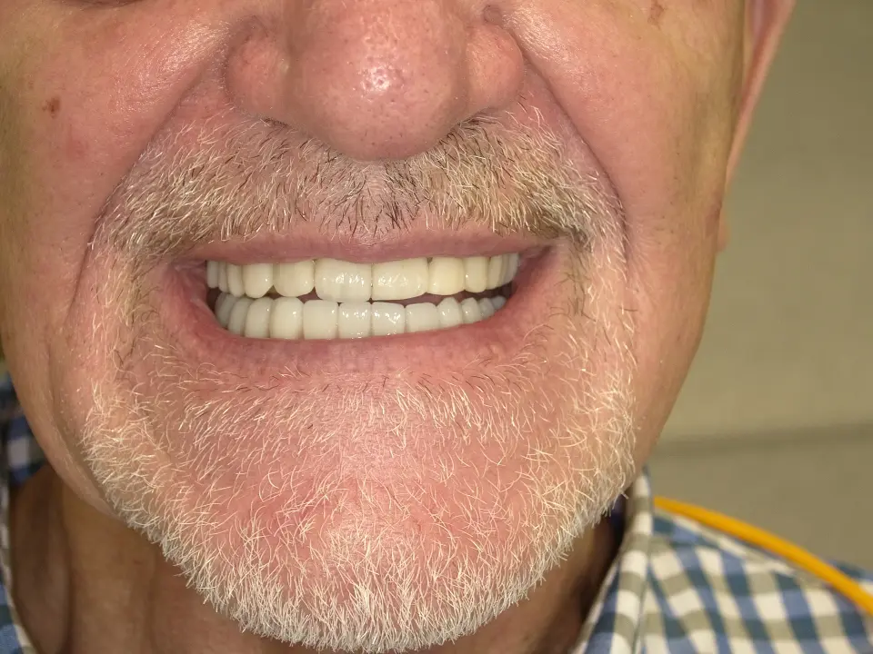 Kompleksan dentalni problem? Ovdje ga ne rješava jedan liječnik, nego cijeli tim
