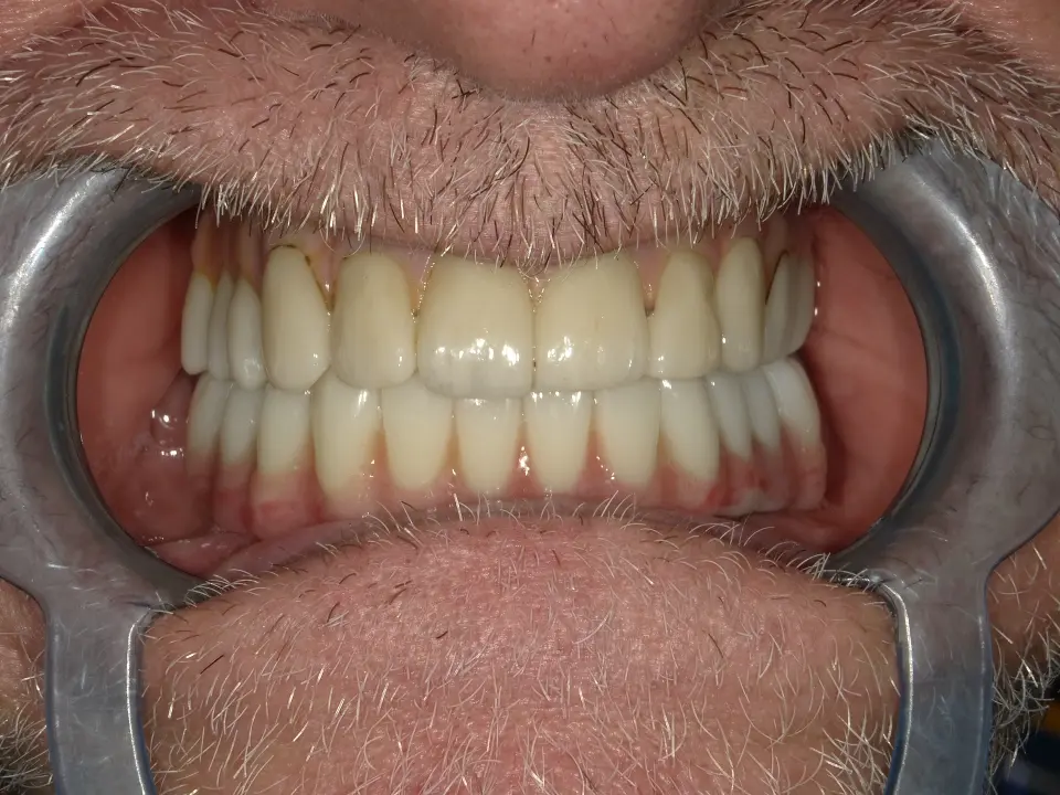 Kompleksan dentalni problem? Ovdje ga ne rješava jedan liječnik, nego cijeli tim