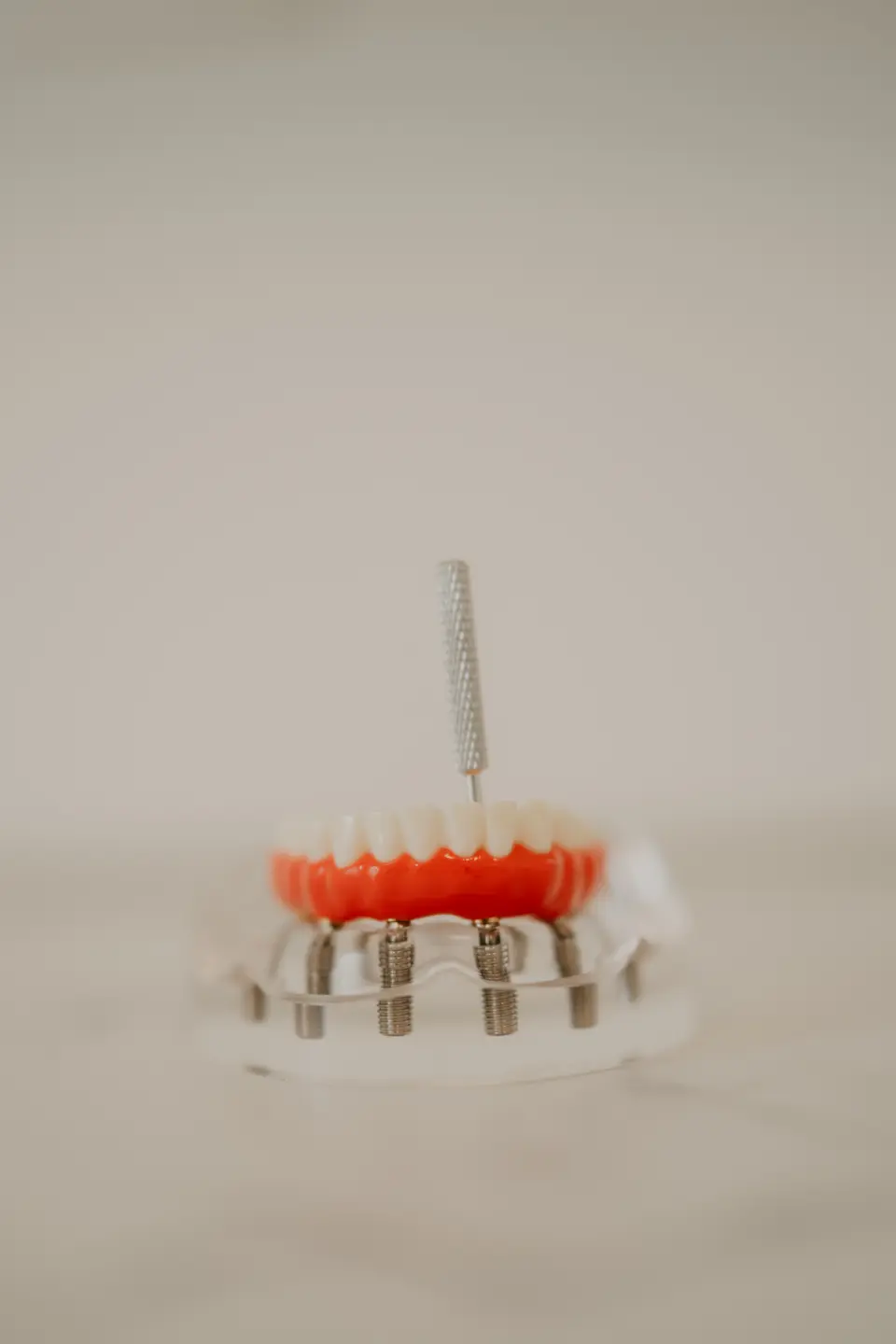 Kompleksan dentalni problem? Ovdje ga ne rješava jedan liječnik, nego cijeli tim