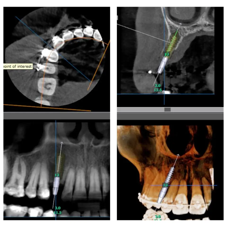 Dental centar Thaler – Sve za savršen osmijeh na jednom mjestu