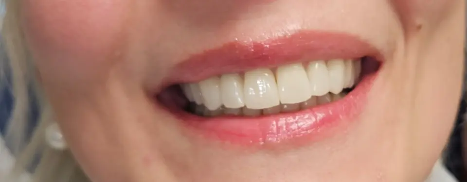 Dental centar Thaler – Sve za savršen osmijeh na jednom mjestu