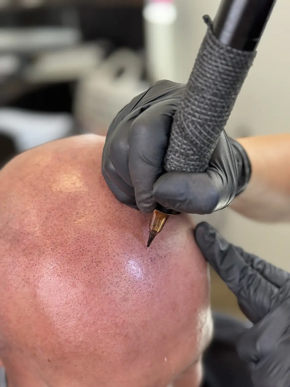 Z Brows & Beauty salon: transformacija kroz scalp micropigmentaciju