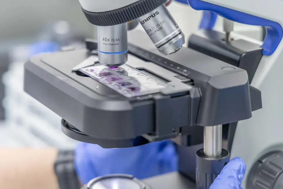 Znate li zašto su preventivne laboratorijske pretrage važne za Vaš organizam?